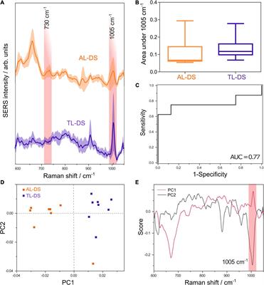 SERS-Based Evaluation of the DNA Methylation Pattern Associated With Progression in Clonal Leukemogenesis of Down Syndrome